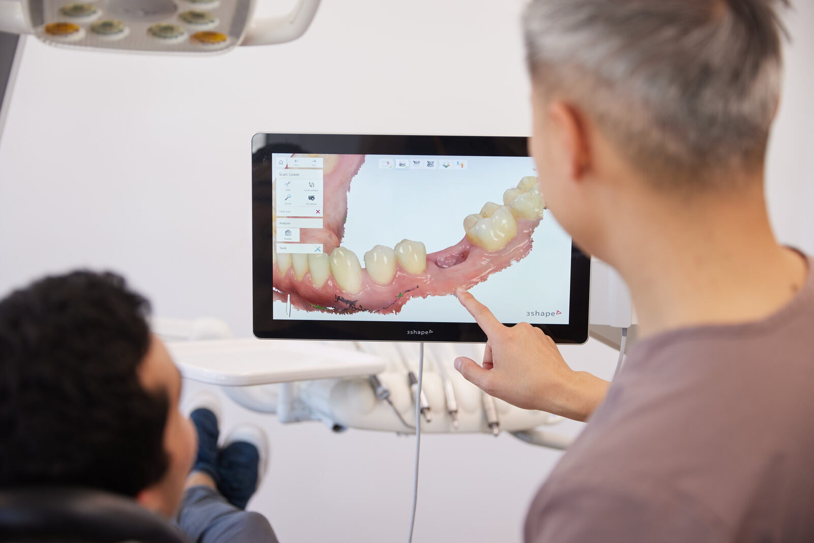 Osseointegration — healing phase
